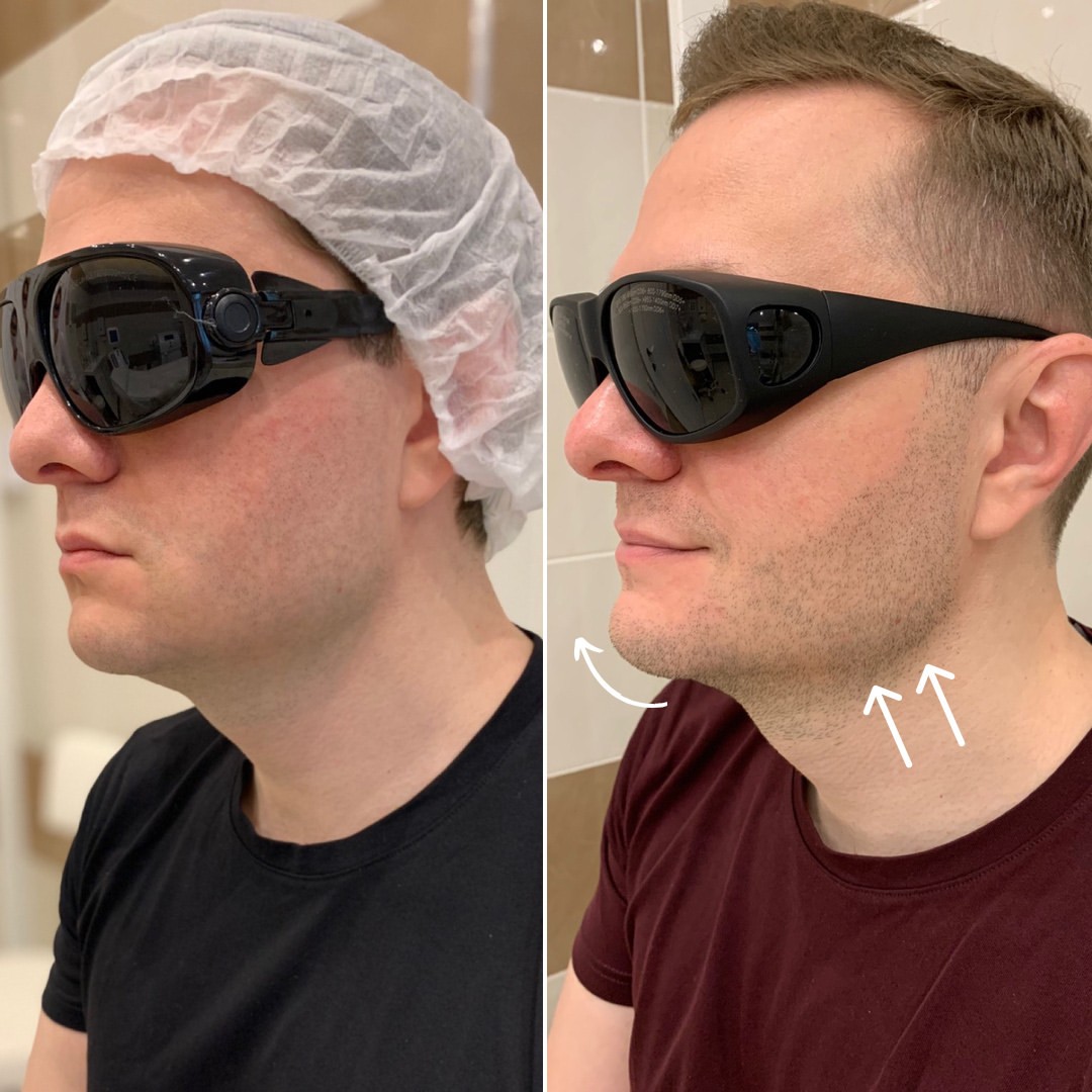 ультраформер для мужчины