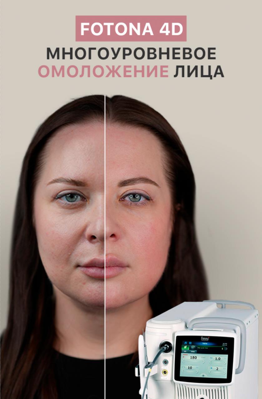 Fotona 4D – многоуровневое лазерное омоложение лица по специальной цене — акция от Age Clinic